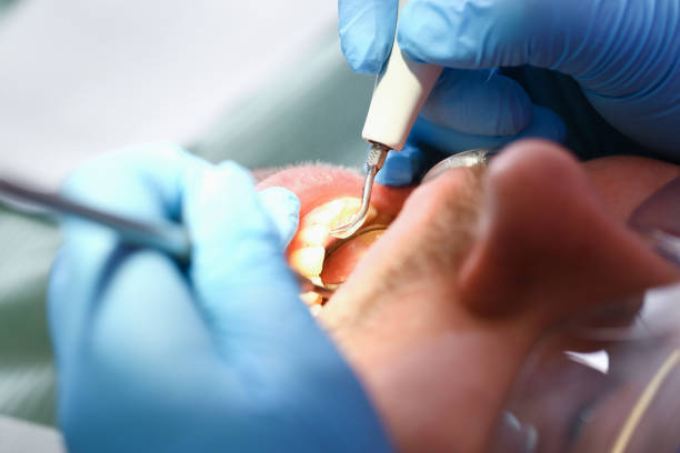 Dentist for Dental Trauma in VA