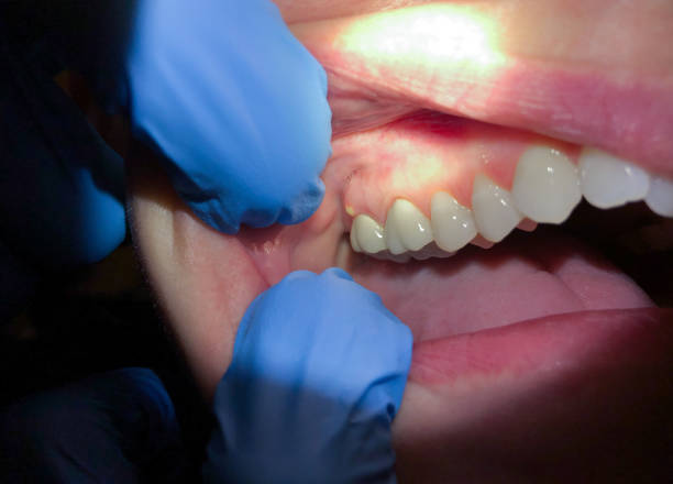 Best Urgent Dental Care  in Carrollton, VA
