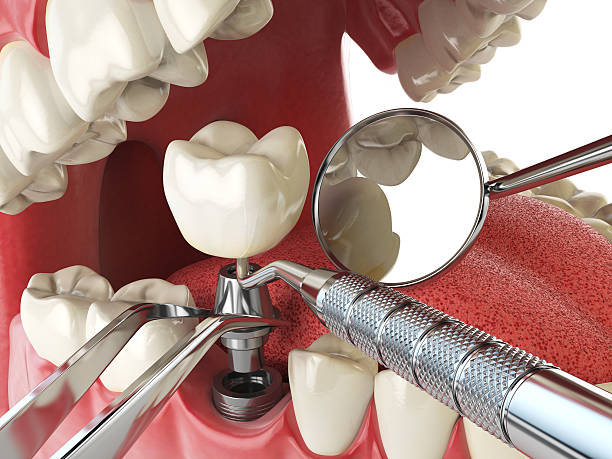 Best Tooth Infection Emergency Dentist  in Carrollton, VA